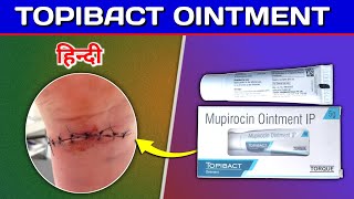 Topibact Ointment  Mupirocin ointment Review in Hindi [upl. by Hershell21]