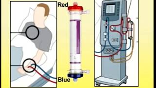 Setting Up of Dialysis Machine [upl. by Arondell509]