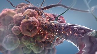 How Superselective IntraArterial Infusion Works for Treating Glioblastoma  Ivy Brain Tumor Center [upl. by Dinin]