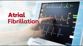 What is Atrial Fibrillation [upl. by Woothen]