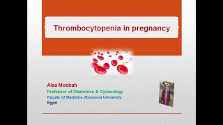 Thrombocytopenia in pregnancy [upl. by Nnainot510]