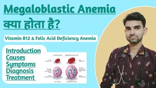 Megaloblastic Anemia in Hindi  Causes Symptoms and Treatment of Megaloblastic Anemia [upl. by Eadwine]