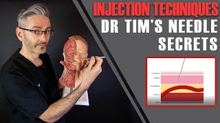 Injection Techniques Best Angles Depths How To Aspirate amp Stabilise Aesthetics Mastery Show [upl. by Secnarf]