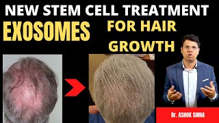 EXOSOMES FOR HAIR REGROWTH  STEM CELL BREAKTHROUGH  Dr ASHOK SINHA [upl. by Hinman241]