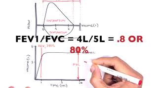 Understanding Spirometry  Normal Obstructive vs Restrictive [upl. by Lepley]