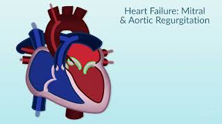 Rheumatic Heart Disease by E Rusingiza  OPENPediatrics [upl. by Itsyrc909]