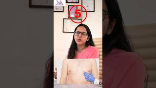 5 Facts Gynecomastia Surgery  Gyno Surgery के 5 जरूरी Facts manboobs chestfat yshort [upl. by Stanford559]