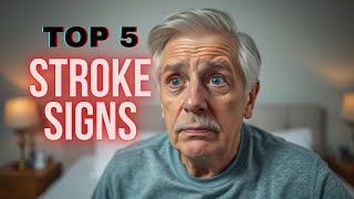 Top 5 Stroke Warning Signs You Can’t Ignore – This Could Save a Life [upl. by Lesiram685]