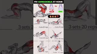 Fix varicocele at home without any surgery varicocele shorts [upl. by Leong]