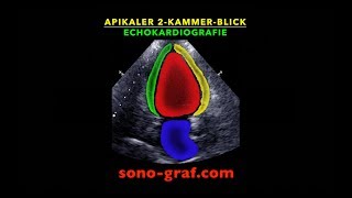 Echokardiografie  Apikaler Zweikammerblick [upl. by Cheslie]