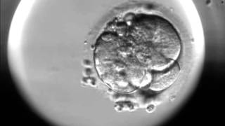 Timelapse of fertilisation of a human egg under the microscope [upl. by Aiz]