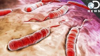 What Exactly Does Cholera Do To Your Body [upl. by Enyrhtak]