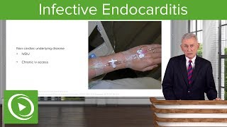 Infective Endocarditis IE Definition amp Epidemiology– Infectious Diseases  Lecturio [upl. by Shama545]