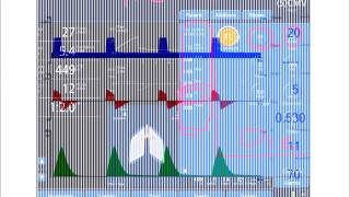 InspiratoryExpiratory Time Ratio IE [upl. by Neerual]