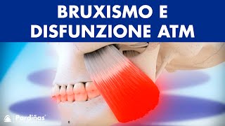 Bruxismo e disfunzione articolazione temporomandibolare © [upl. by Ainirtak]