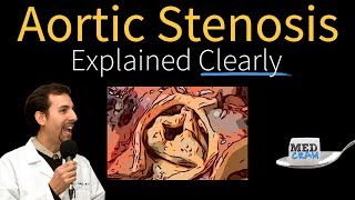 Aortic Stenosis Explained Clearly  Diagnosis and Treatment [upl. by Xonk659]