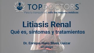 ¿Qué es la litiasis renal Conoce todos los detalles [upl. by Talich]