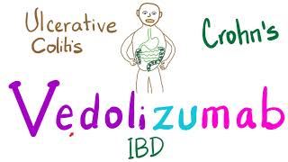 Management of Inflammatory Bowel Disease IBD Crohns and Ulcerative Colitis [upl. by Odrawde768]