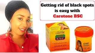 Carotone black spot Corrector review Fade off black spots quickly [upl. by Gaige66]