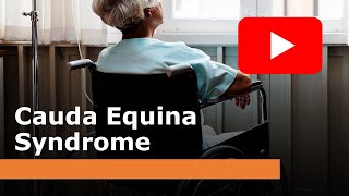 Cauda equina syndrome [upl. by Sclater744]