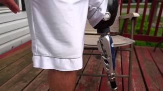 AmputeeOT How An Above Knee AK Prosthetic Leg Works [upl. by Amelie140]