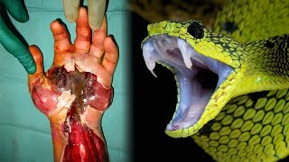 Les 20 serpents les plus venimeux et dangereux du monde [upl. by Dorie960]