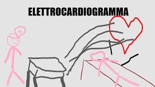 I segreti più o meno dellELETTROCARDIOGRAMMA  Spiegazione [upl. by Eelame327]