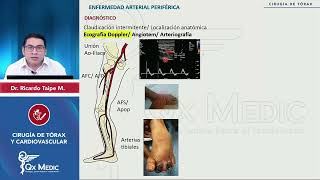 RM 2024 CT y CV 5 E Arterial periférica Isquemia aguda extremidades aneurisma y disección aorta [upl. by Bigler]