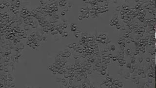 17Differentiation to osteoclasts part1 [upl. by Silbahc]