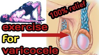 varicocele exercise  varicocele exercise treatment  yoga for varicocele  Hindi [upl. by Eelrebmyk852]