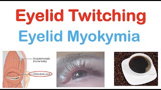 Eyelid Twitching Eyelid Myokymia  Triggers Pathophysiology Symptoms Diagnosis Treatment [upl. by Rorry]