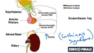 Understanding The Dexamethasone Suppression Test [upl. by Enomed]