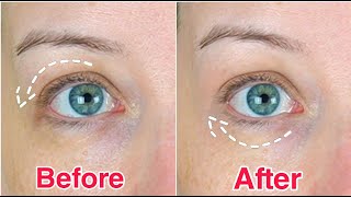 10 SECOND FIX FOR DOWNTURNED EYES with 1 Product [upl. by Atteirneh]