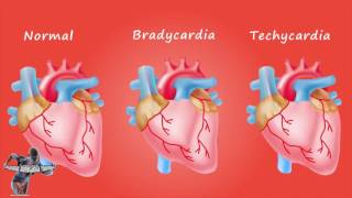Bradicardia e tachicardia cuore [upl. by Athelstan126]