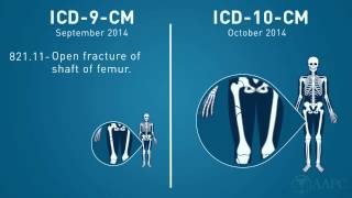 What is ICD10 [upl. by Eelibuj82]