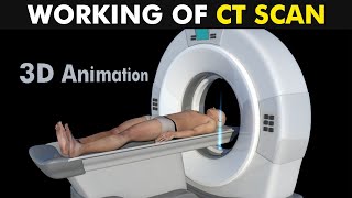 Working Of CT Scan 3D Animation UrduHindi [upl. by Kamat]