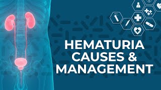 What are the Most Common Causes of Hematuria Blood in Urine [upl. by Ydroj]