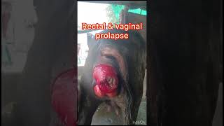 Prolapse l uterine prolapse l rectal prolapse l vaginal prolapse l dr Umar khan [upl. by Notxed632]