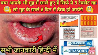 सिर्फ ये टेबलेट खा लो मुह के छाले 1 दिन मेें ठीक हो जायेंगे  Stomatitis Treatment in hindi  Ulcer [upl. by Einahc]