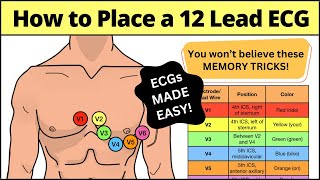 12 Lead ECG Placement MADE EASY EMT Nursing Paramedic ecg nursing [upl. by Dniren]