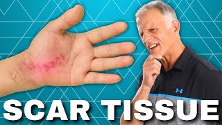 How to Get Rid of Scar Tissue After Surgery or Injury Hardened [upl. by Anerual47]