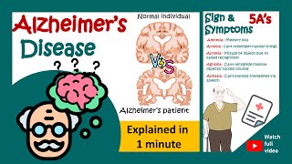 Alzheimers disease in 1 minute  1minute pathology Pathological hallmarks of Alzheimers disease [upl. by Jeavons938]