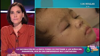 Fiebre alta o sarpullidos Boticaria García explica los síntomas del sarampión  Zapeando [upl. by Quinlan747]