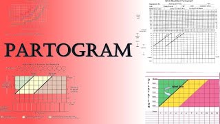 Partogram  Labour Monitoring and Assessment of Fetal WellBeing  TOACS amp OSCE Station [upl. by Idmann]