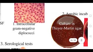 Meningococcal meningitis [upl. by Ttegdirb]