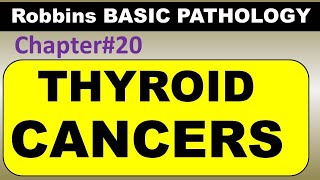 Ch20  Thyroid Cancers  Endocrine Pathology Robbins Pathology  Dr Asif Lectures [upl. by Yreffeg483]