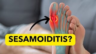 SesamoiditisHome Remedies What is It Pain at the base of Big Toe [upl. by Nedry]