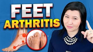 5 Causes for Feet Arthritis A Rheumatologist Perspective [upl. by Ier]