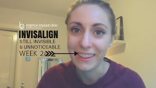 Invisalign Treatment Vlog After 2 weeks [upl. by Ereveniug]