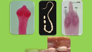 Practical helminthology Trematodes Cestodes nematodes [upl. by Agripina]